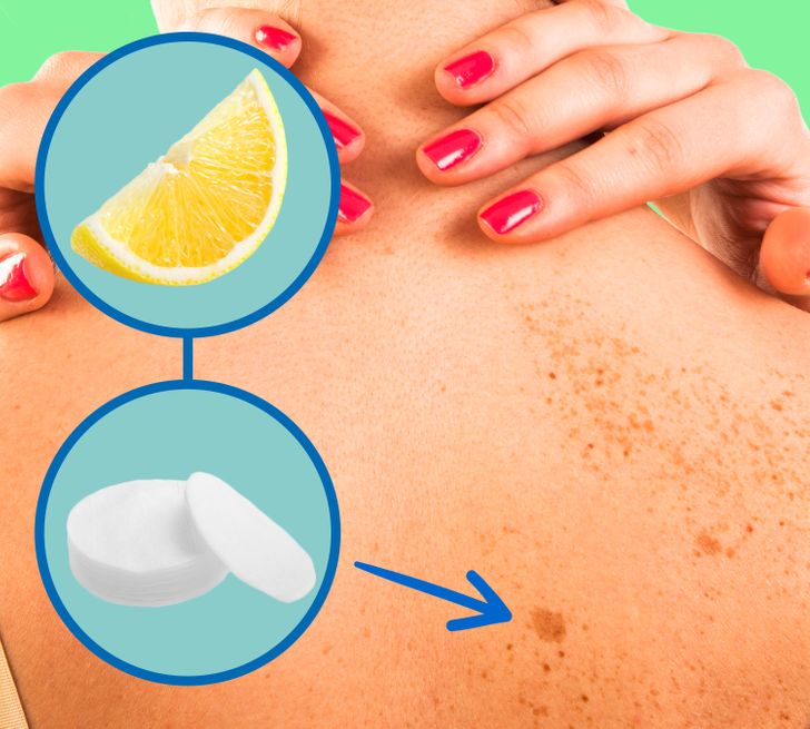 11 Ways to Remove Dark Spots From Your Skin