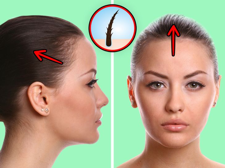 What Can Happen to Your Hair If You Wear Ponytails Way Too Often