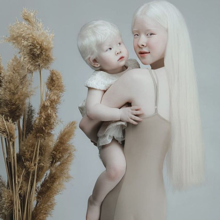 Albino Sisters Born 12 Years Apart Excite the Internet With Their Photos