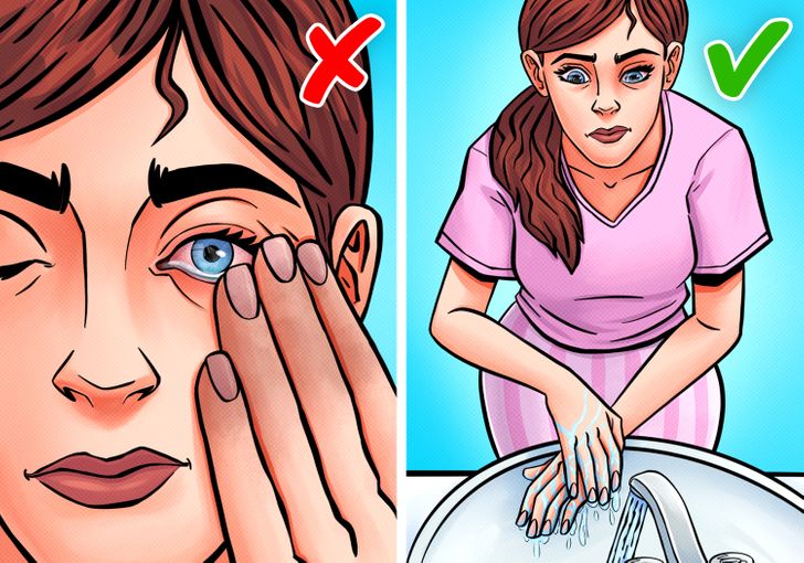 7 Ways To Safely Remove Something Stuck In Your Eye Bright Side