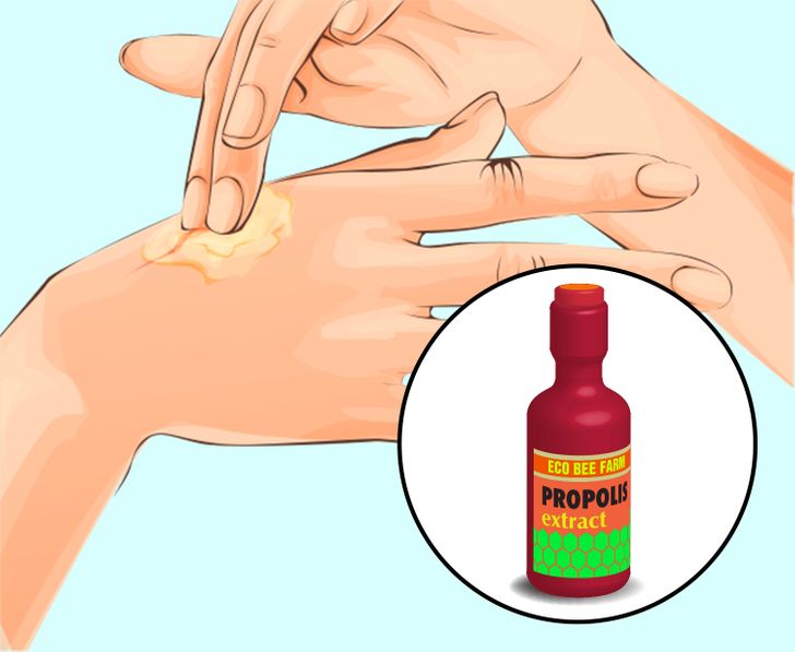 How to Remove Annoying Papillomas and Warts Once For All