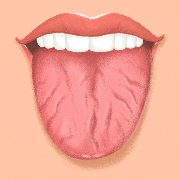 9 Things Your Tongue Is Trying to Tell You About Your Health