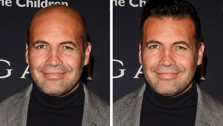 We Imagined 15 Bald Celebs With a Full Head of Hair, and They Look  Irresistible