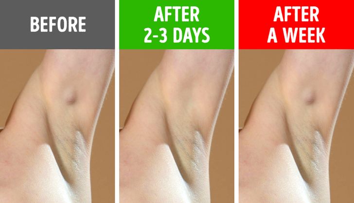 6 Armpit Signals That Can Indicate Health Issues