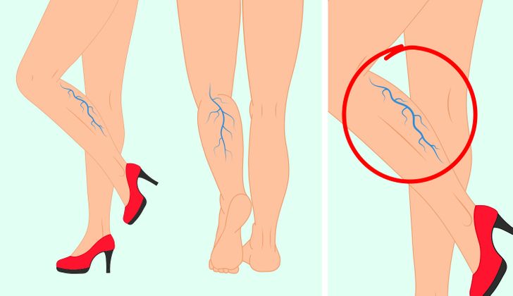 What Can Happen to Your Body If You Wear High Heels Every Day