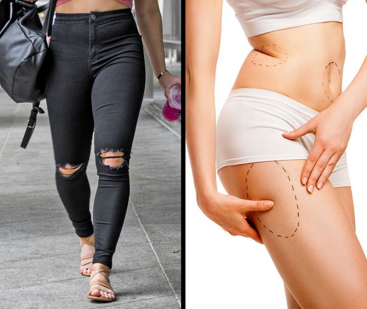 7 Ways Tight Clothes Could Be Killing Your Health – Sozy