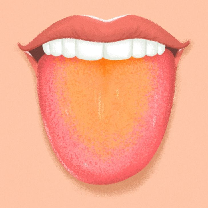 9 Things Your Tongue Is Trying to Tell You About Your Health