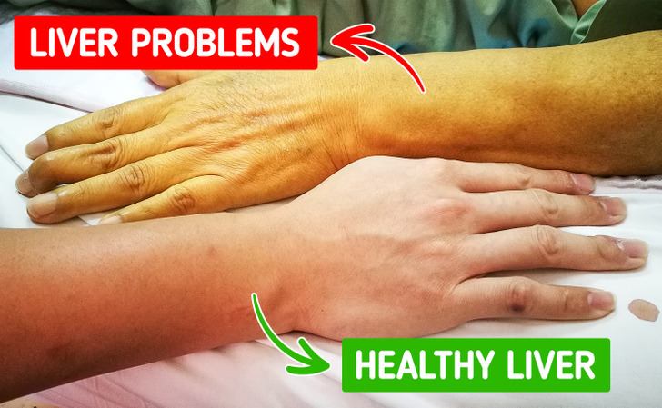 8 Warning Signs Your Body Is Giving You That You Shouldn’t Ignore