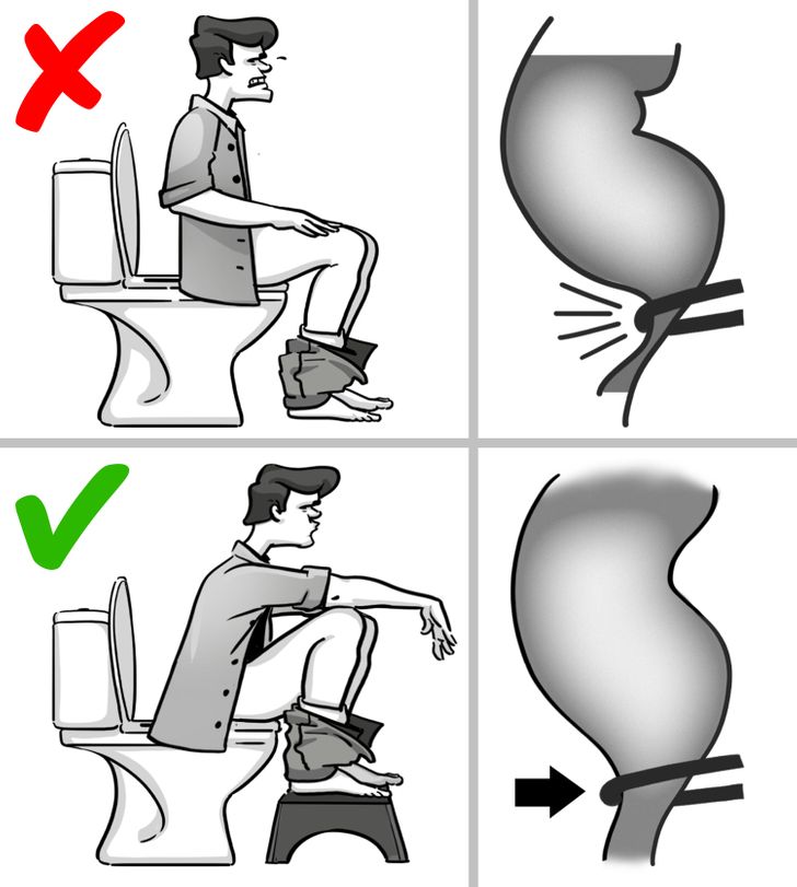 6 Quick Ways to End Your Constipation