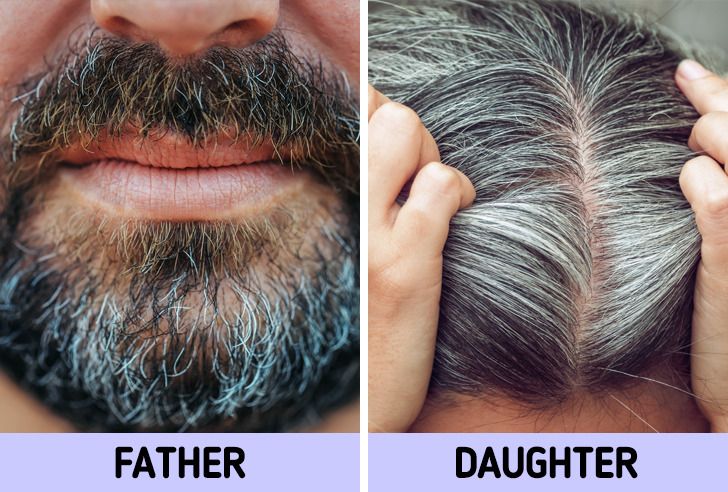 Why Your Hair Might Be Turning Gray at a Young Age