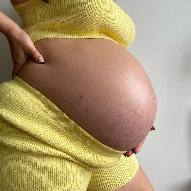 Ashley Graham Shares Postpartum Experience