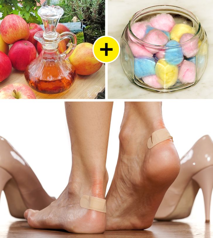 Best Fix For Calluses - How I Fixed My Dry Feet — First Thyme Mom