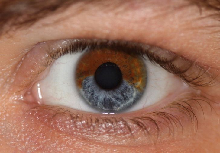 7 Things That Can Change Your Eye Color