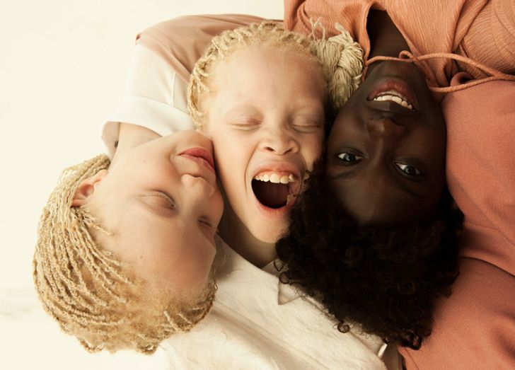 The Utterly Unique Appearance of These Twins Has Stunned the Internet