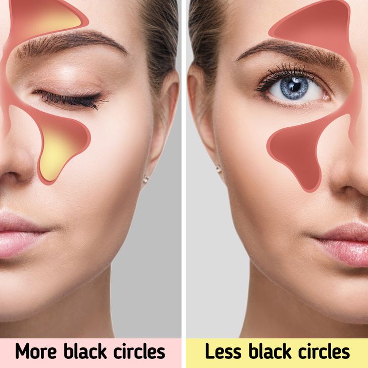8 Tips to Reduce Black Circles and Tiredness Under the Eyes