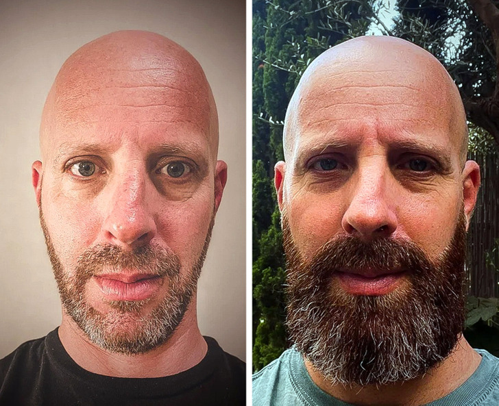 15+ Photos That Prove a Beard Changes Everything