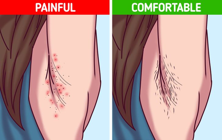 5+ Reasons Why Accepting Your Body Hair Can Upgrade Your Life
