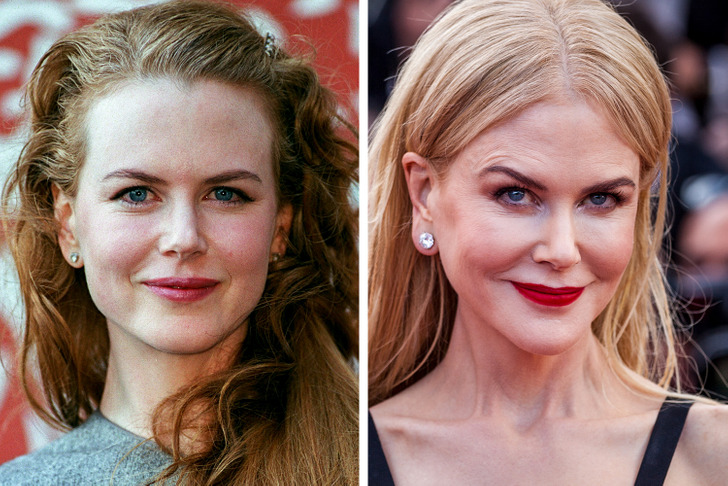 16 Celebrities Who Regretted Their Cosmetic Procedures