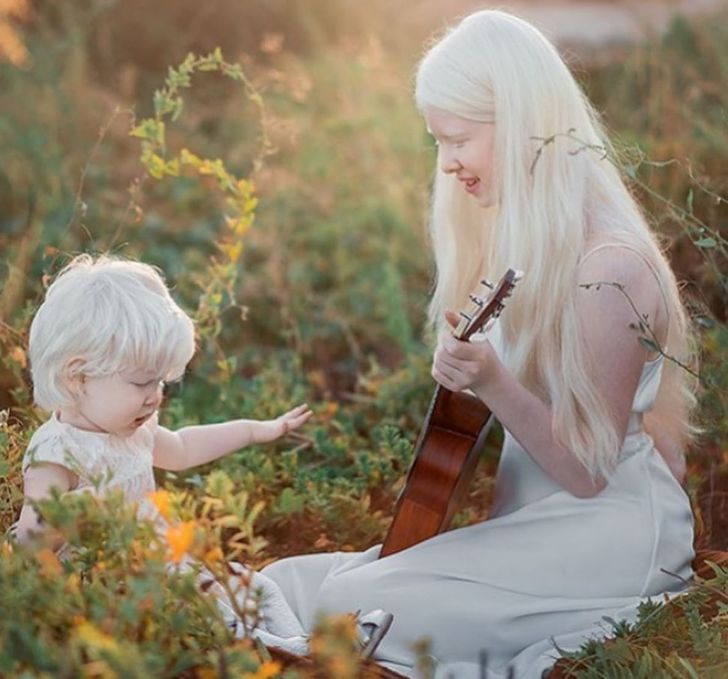 Albino Sisters Born 12 Years Apart Excite the Internet With Their Photos