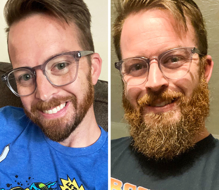 A Man Before And After A Beard A Whole New Person Asviral 