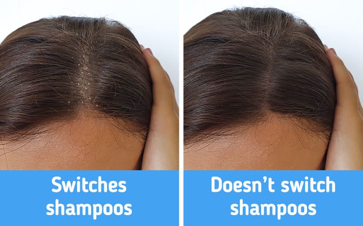 10 Mistakes to Avoid for a Healthy Scalp and Hair