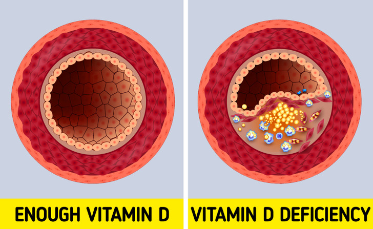6 Warning Signs That You Are Lacking Vitamin D