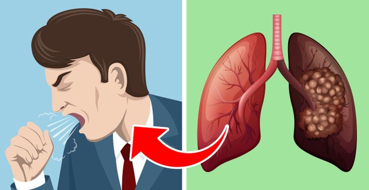5 Signs Your Lungs Are Gasping for Help