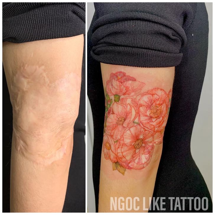 Bright Side: A Vietnamese Artist Uses Her Magical Touch to Help People Regain Self-Confidence by Covering Their Scars With Art - Ngoc Like Tattoo