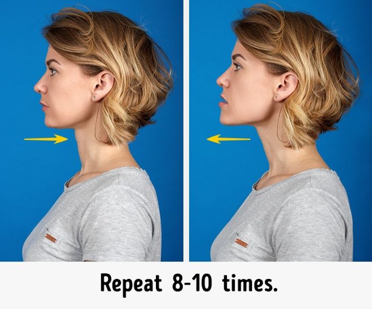 Chin exercises receding Receding Chin: