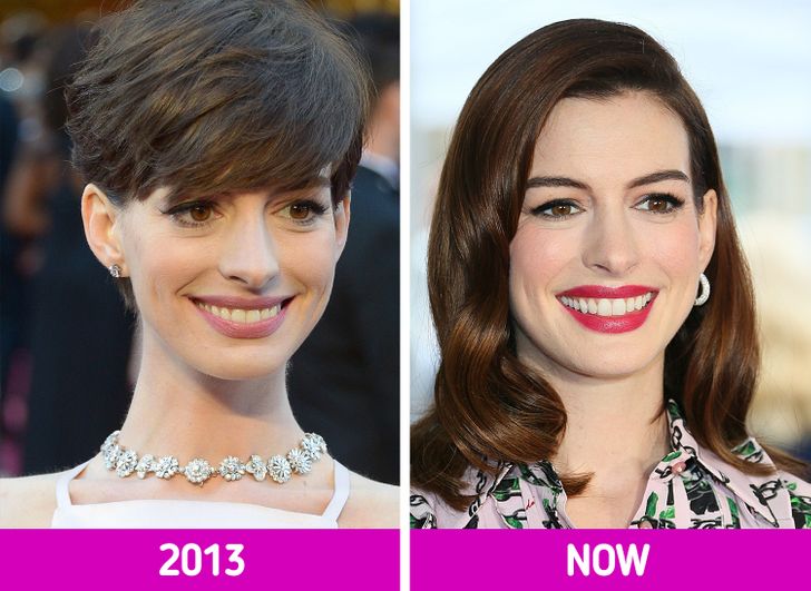 16 Stars That Worked Hard on Their Image and Look Amazing Now