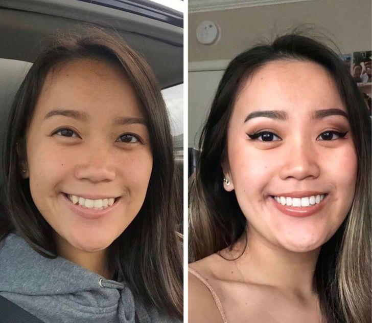 20 People That Got Plastic Surgery and Are Rocking Their New Looks