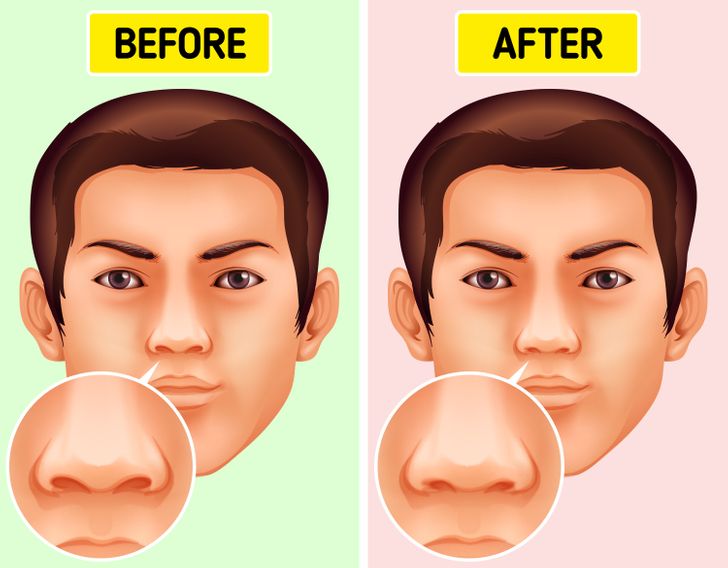 Prečo si vyberanie nosa nie je len neslušné, ale môže byť aj škodlivé