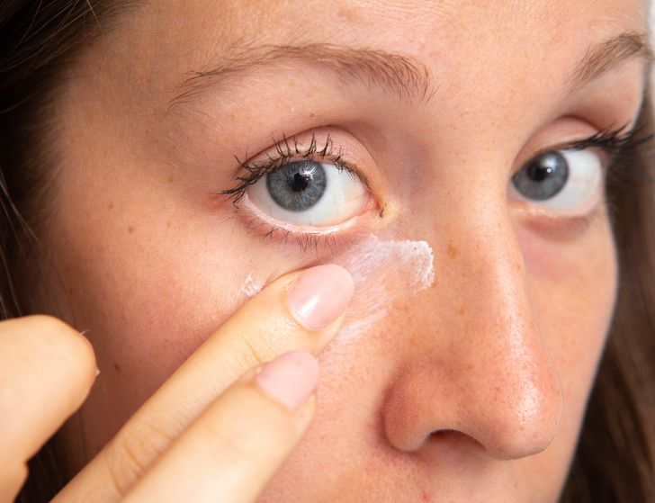 8 Tips to Reduce Black Circles and Tiredness Under the Eyes