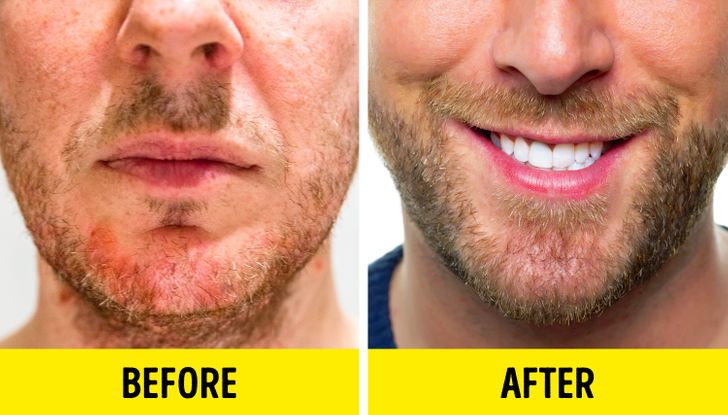 7 Science-Based Reasons Why You Can't Grow a Beard