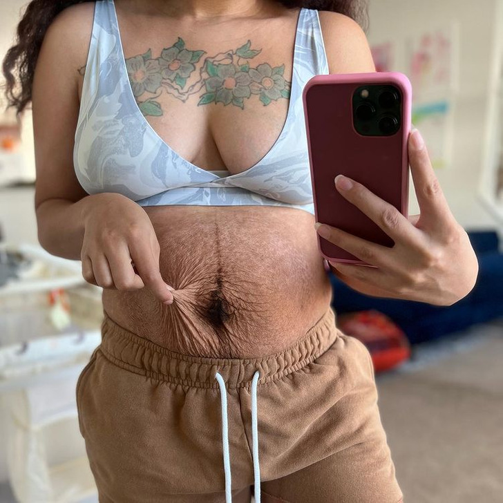 8 Moms Show Off Their 'Real' Postpartum Bodies and How They're Learning to  Love Them