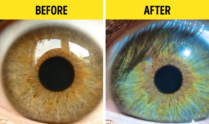 7 Things That Can Change Your Eye Color