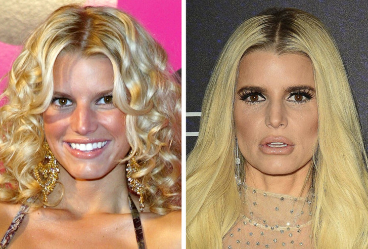 15+ Celebrities Whose Dramatic Transformation Left Us Speechless ...