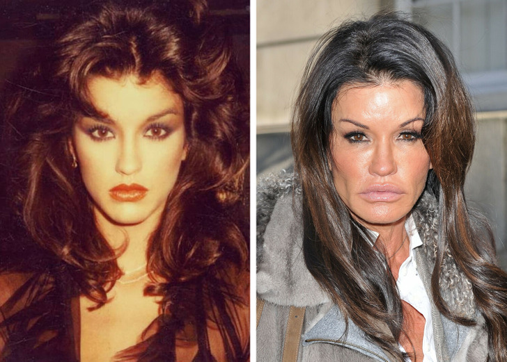 12 celebrities who've talked about plastic surgery and cosmetic procedures