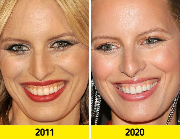 17 Pairs of Photos That Show How the Faces of Top Models Change With Time