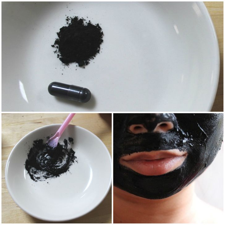 8 Natural Ways to Get Rid of Blackheads and Whiteheads Fast
