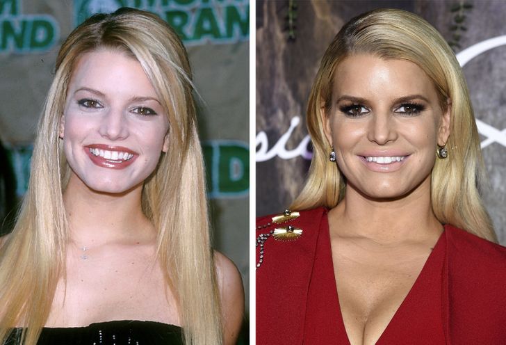 What Celebrities Looked Like Before They Tweaked Their Image / Bright Side