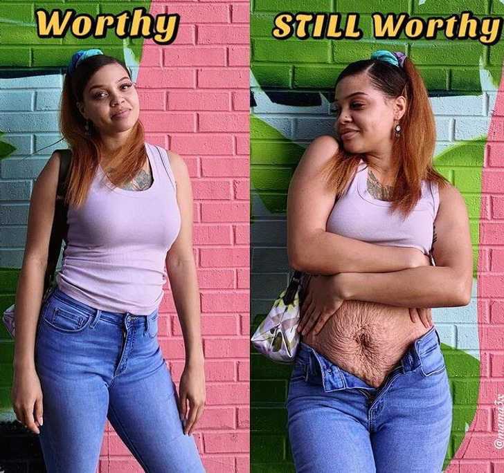 Women Are Sharing Honest And Raw Photos Of Postpartum Bodies That