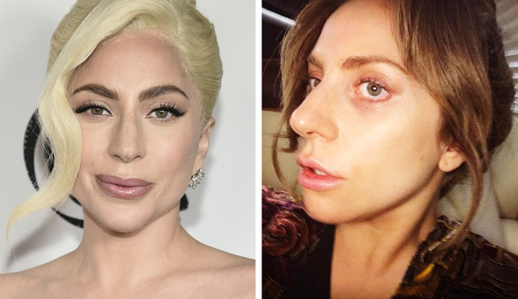 13 Celebrities Who Remind Us Beauty Doesn’t Equal Perfection