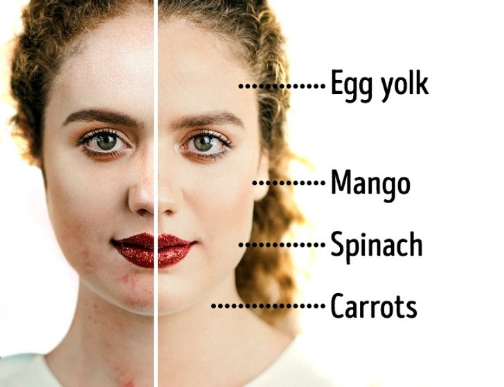 8 Diet Secrets From a Dermatologist That Will Make Your Skin Perfect