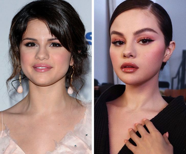 17 Celebrities Who Decided to Say Goodbye to Their Chubby Cheeks