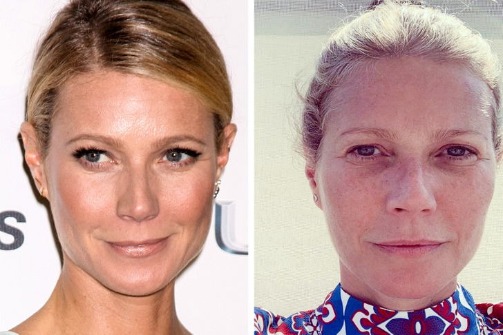 16 Celebrities Who Regretted Their Cosmetic Procedures