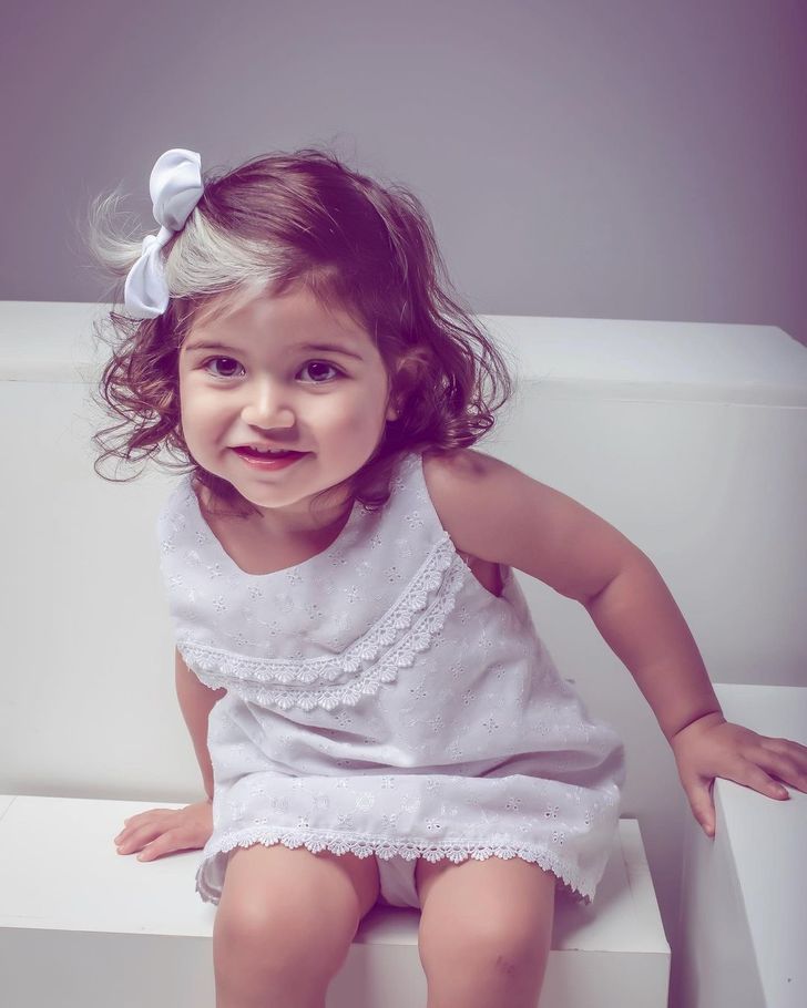 This Baby Girl Who Was Born With Gray Hair Is Proof That Our Flaws Make Us More Beautiful