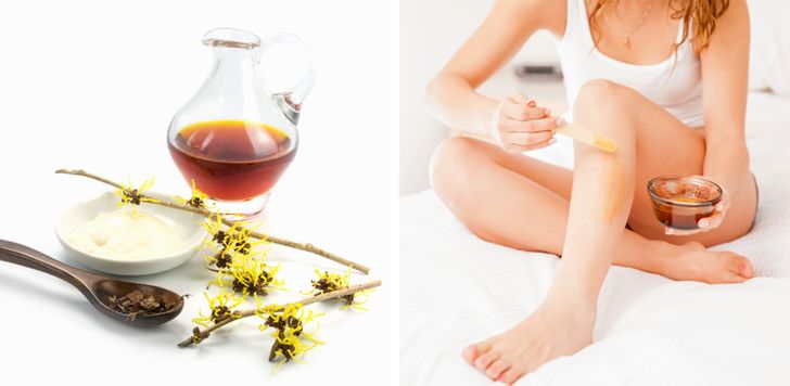 10 Natural Remedies and Exercises to Get Rid of Nasty Varicose Veins