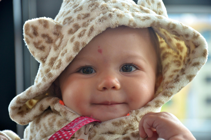 Close-up of a baby wearing a giraffe onesie smiling, birthmark on forehead.