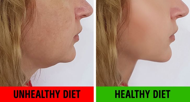 Lose fat in neck and face sale